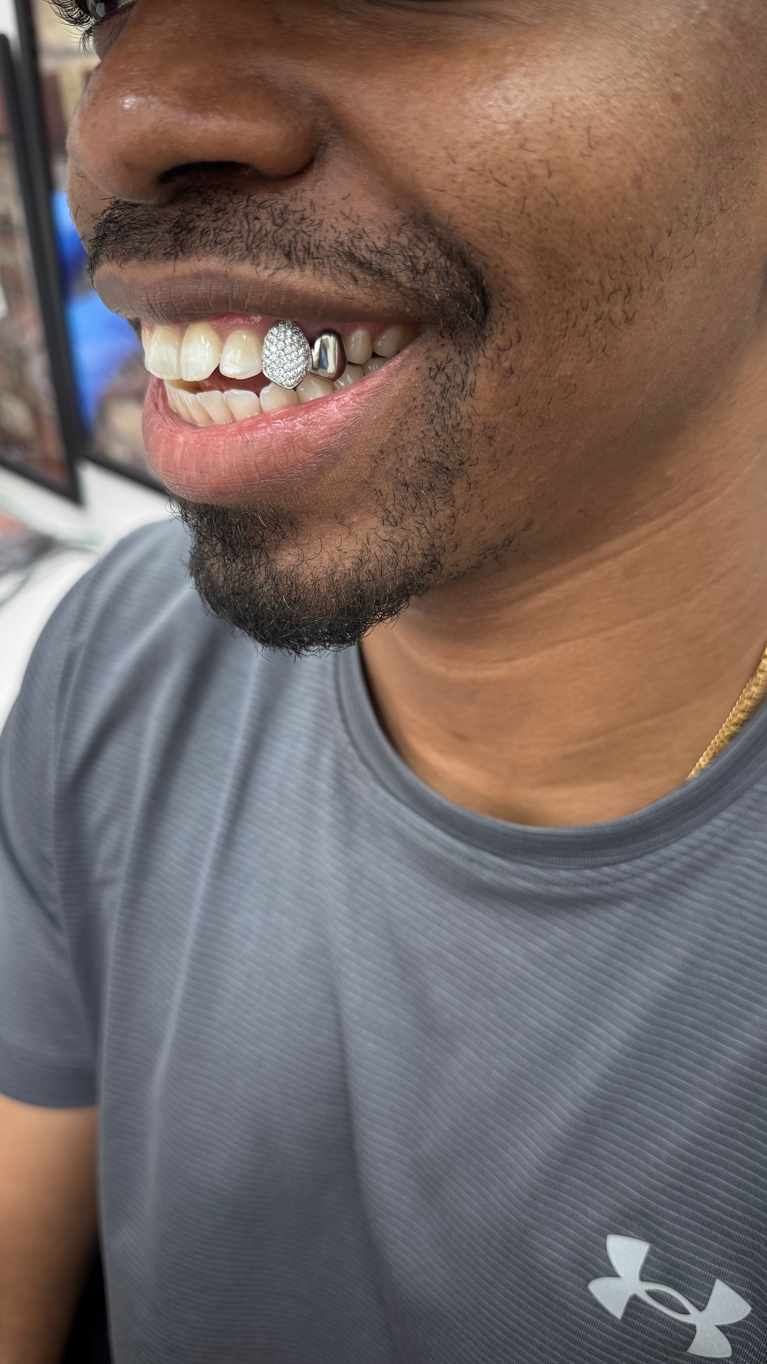 Iced out tooth
