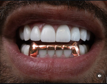 London Bridge solid canines