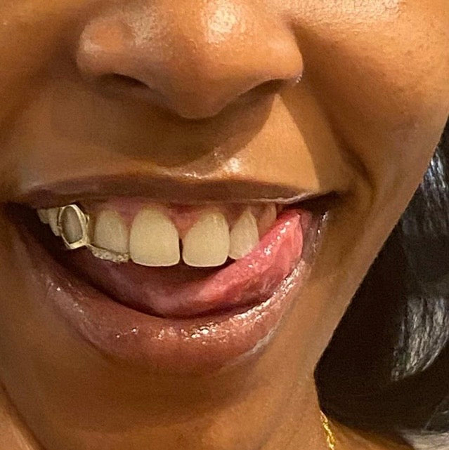 Window with diamond Inlay Design