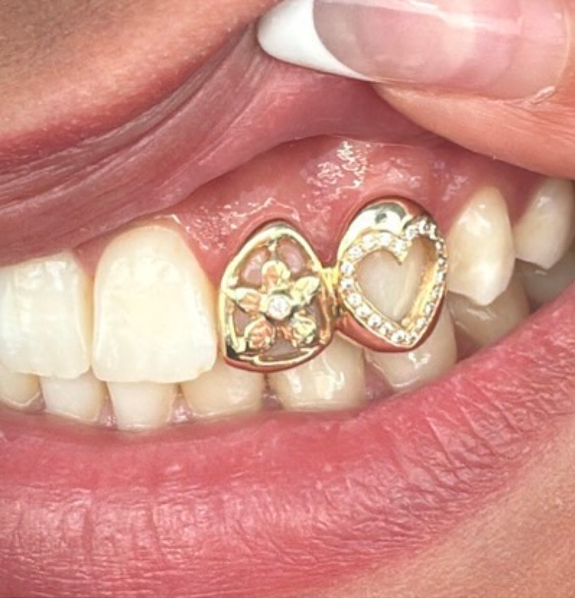 Flower & Diamond heart grillz combo
