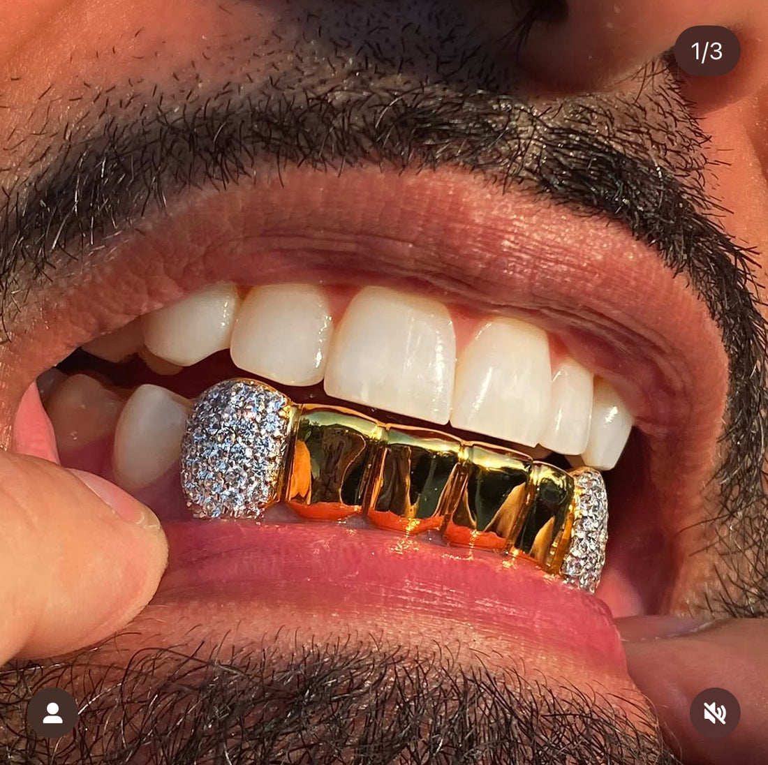 Bottom 6 with iced canines