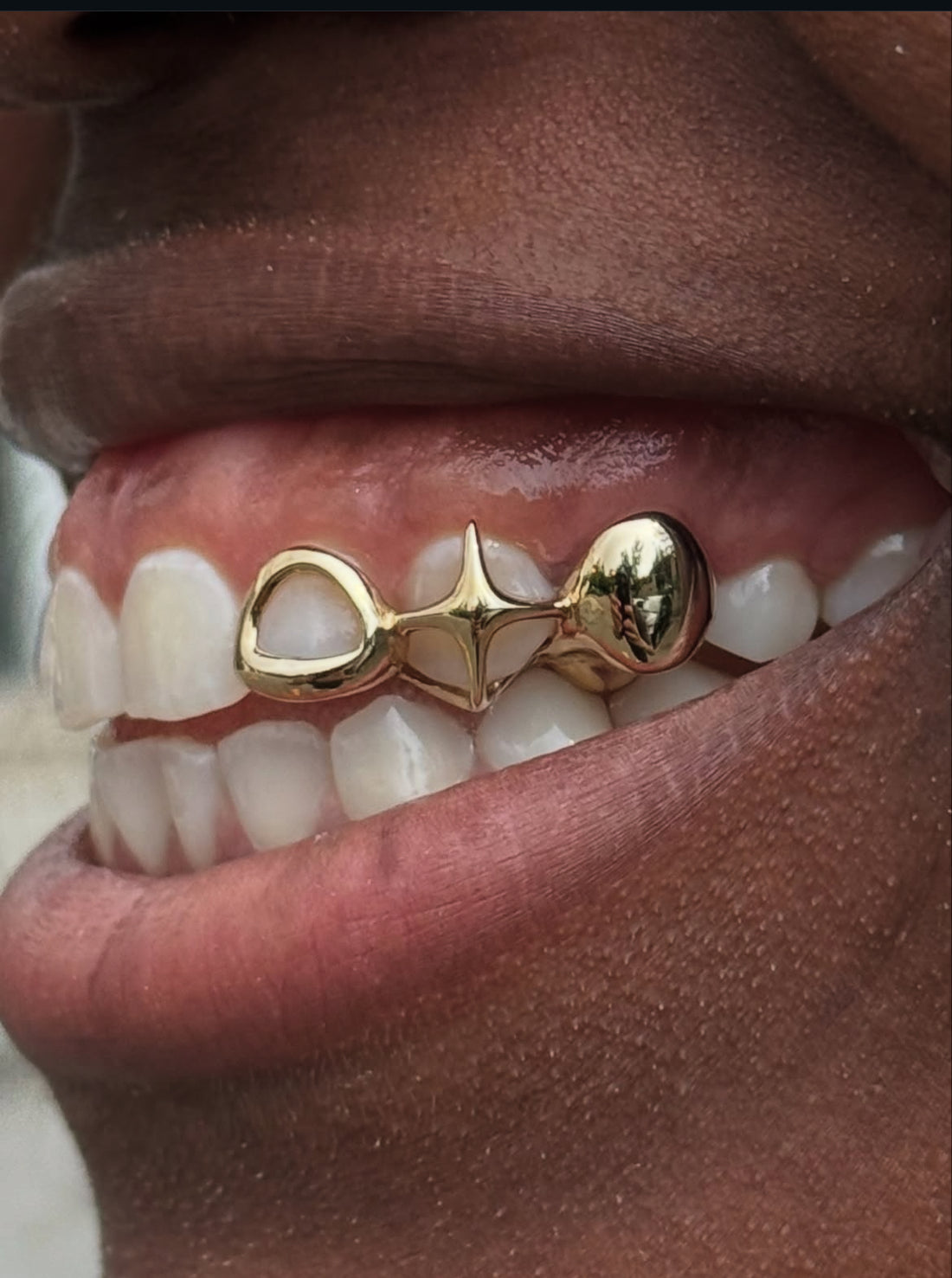 Window + sparkle + solid 3pc set