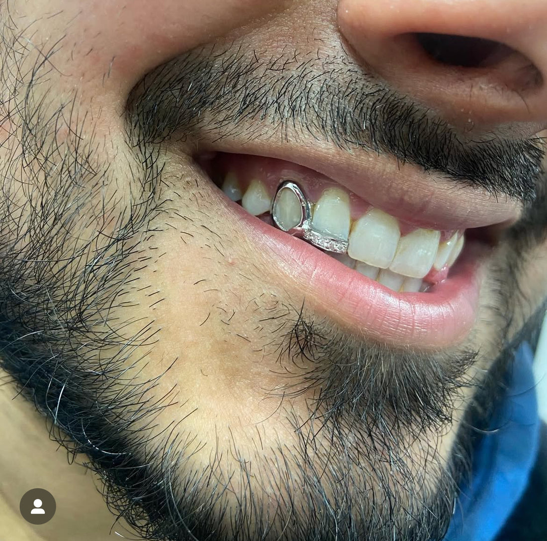 Window & diamond Inlay grillz