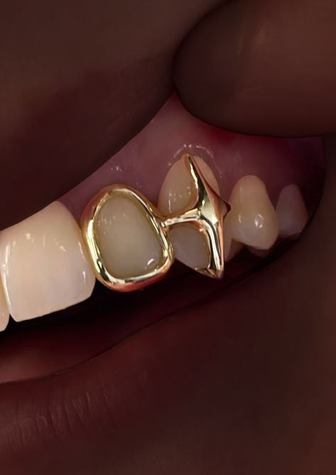Sparkle + window grillz set