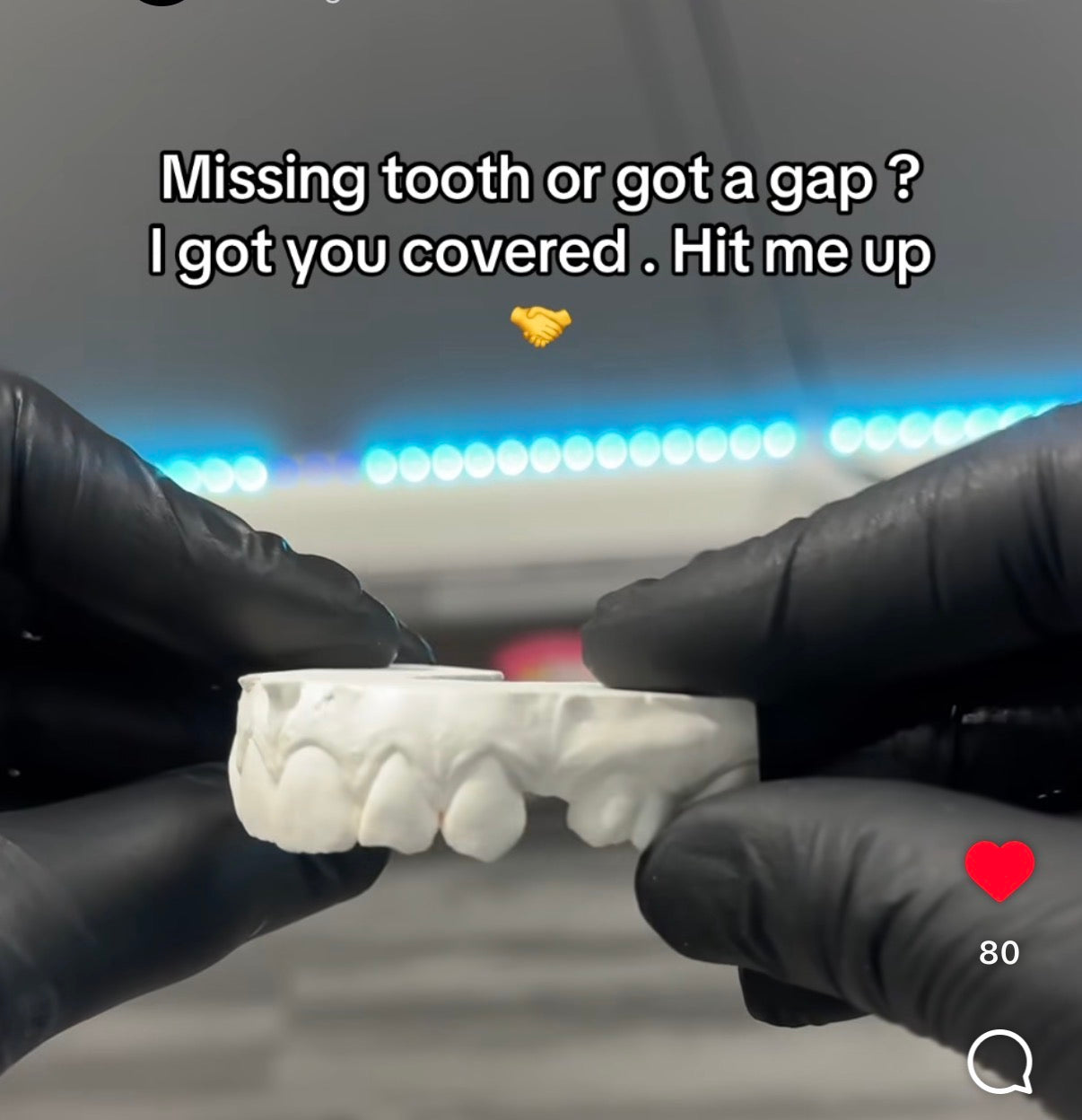 Missing tooth & cap