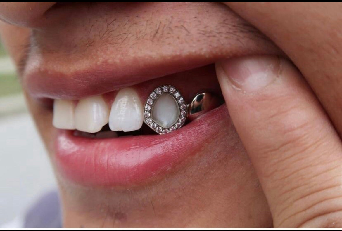 Diamond Window Design