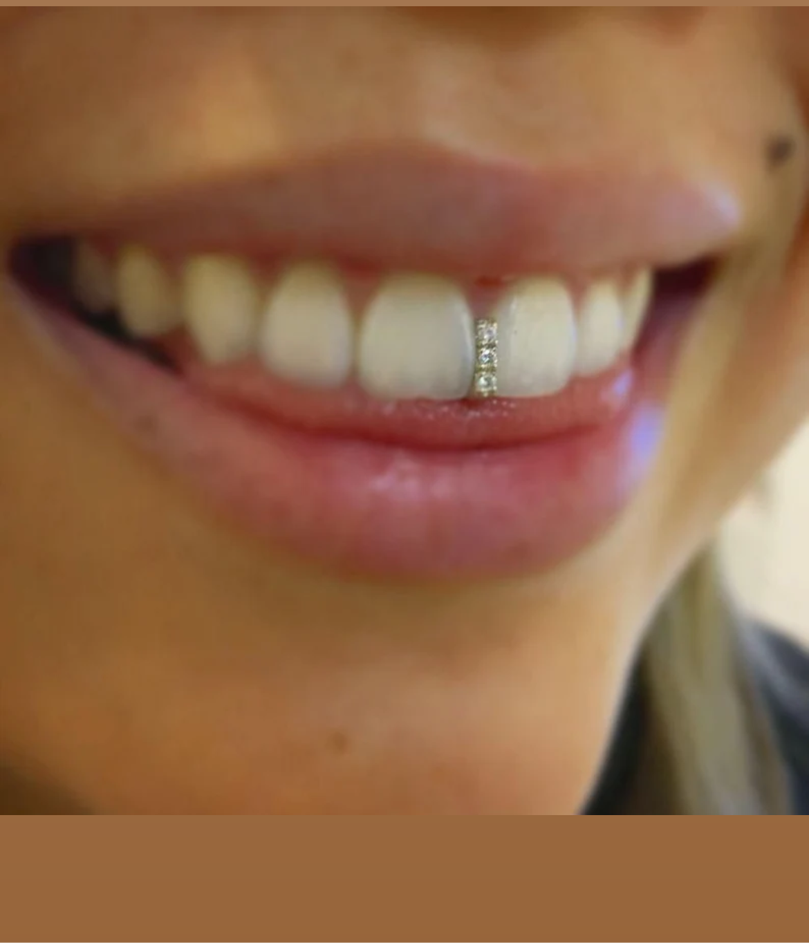 Diamond Gap filler/ Strip Design