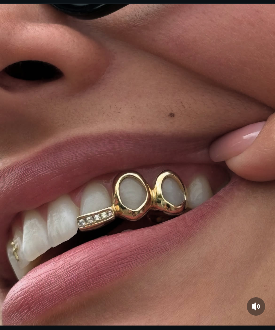 Double window + diamond inlay