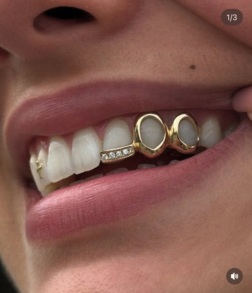 Double window + diamond inlay