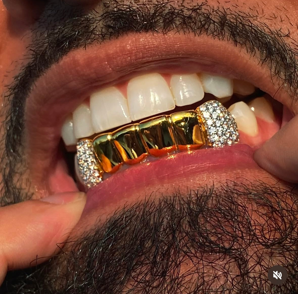 Bottom 6 with iced canines