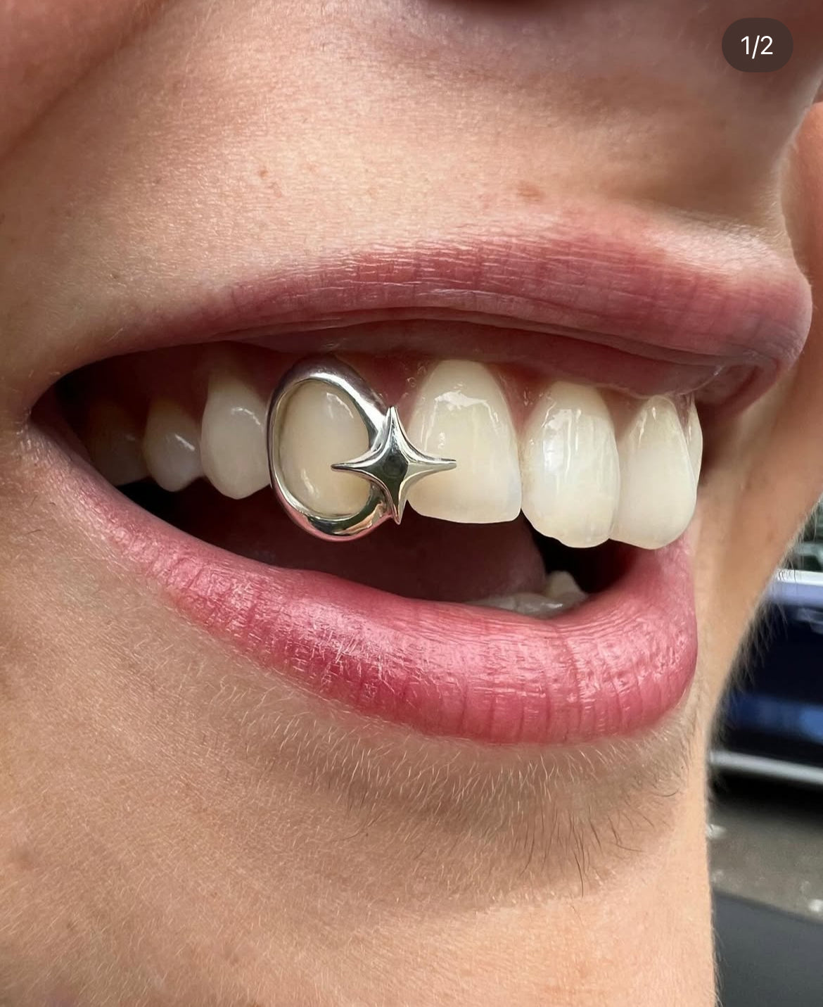 Window sparkle grillz