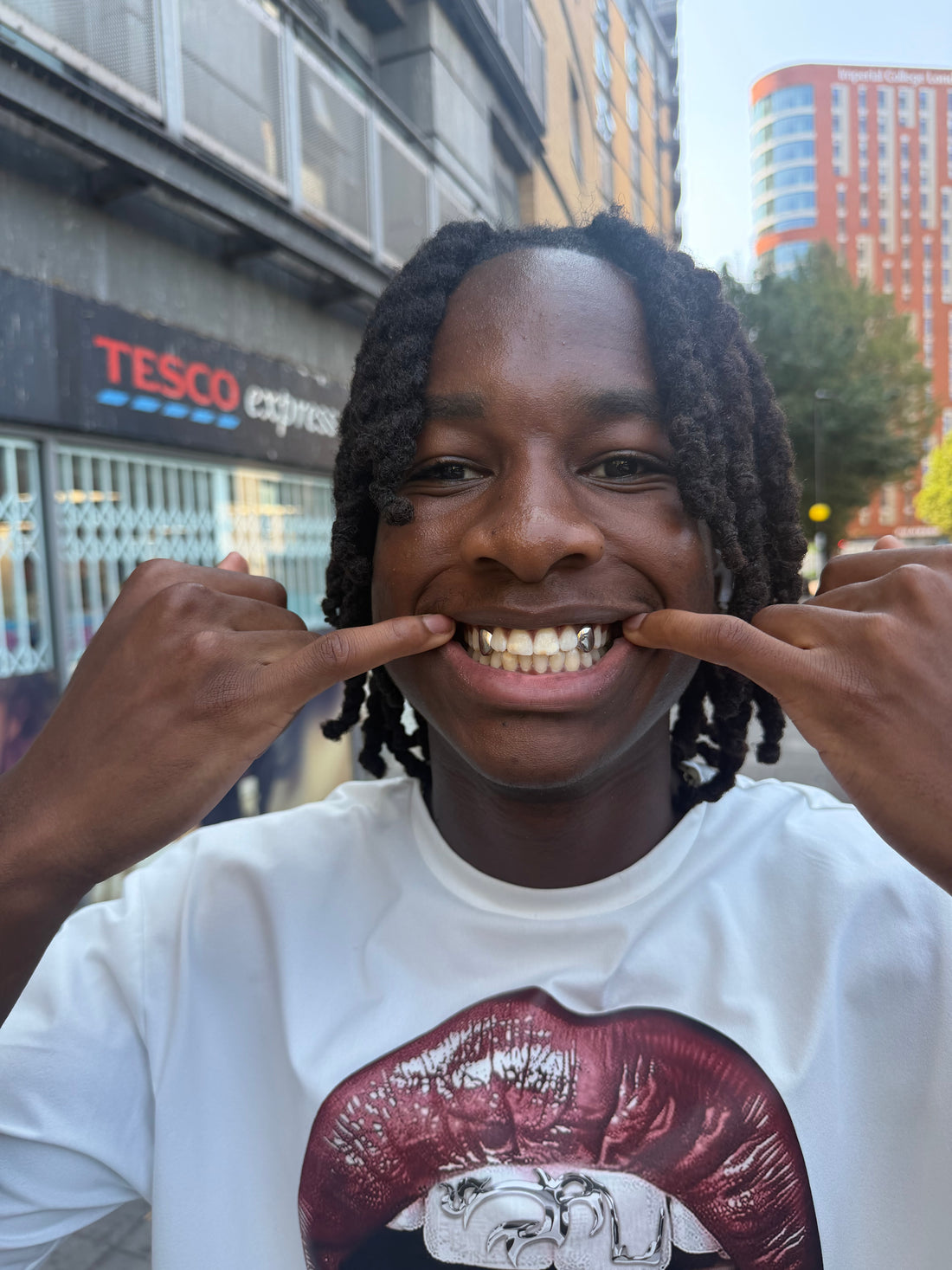 Two Solid Caps (any two teeth )