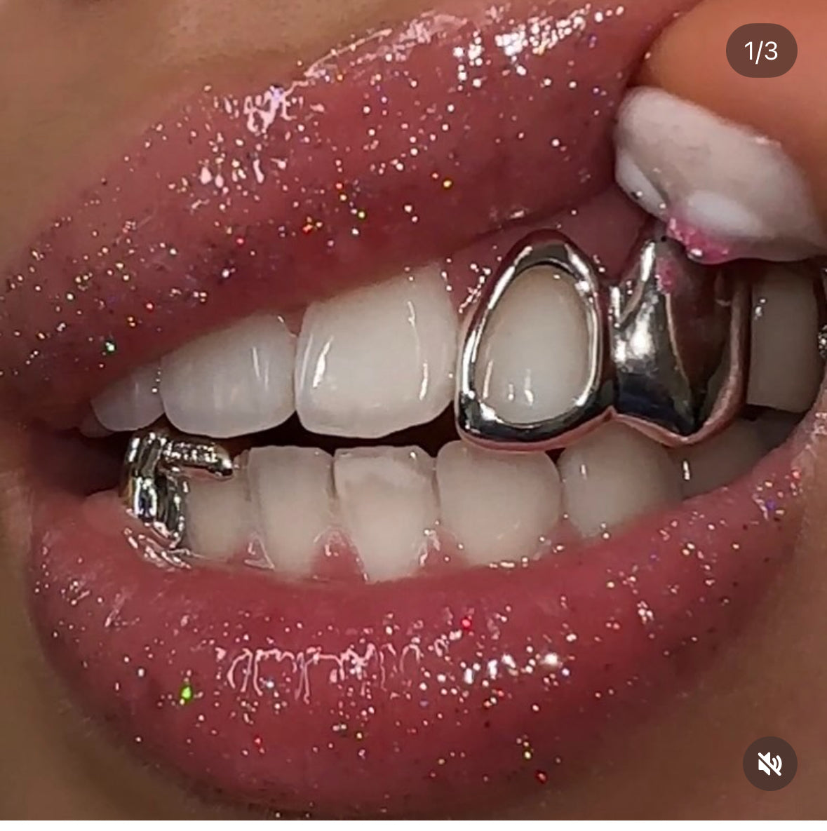 Window and Solid Cap Set