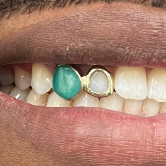 Enamel cap *Any colour* and Window set