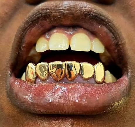 Lower 6 gold Grillz