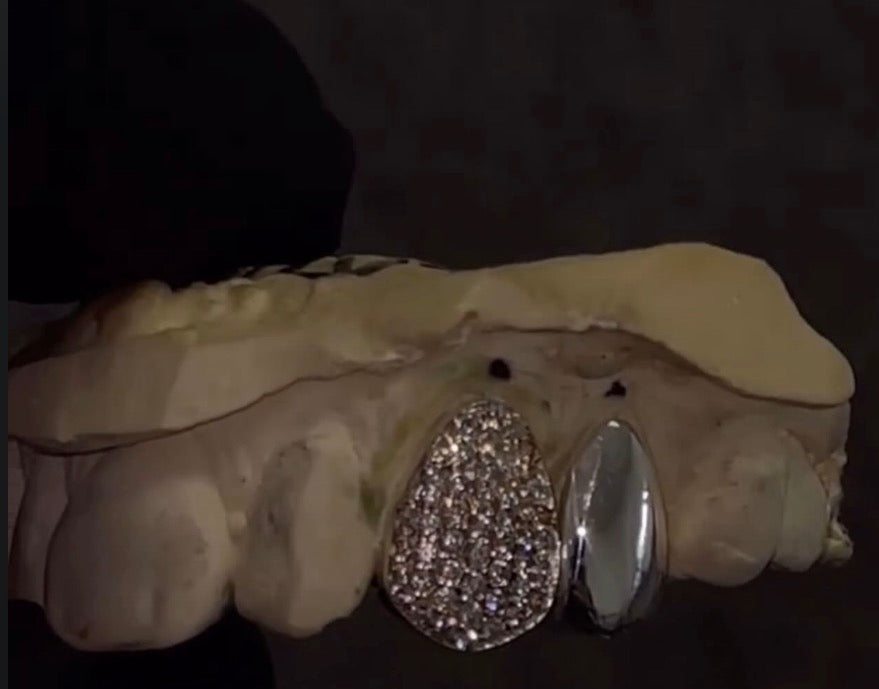 Custom solid& iced out Grillz
