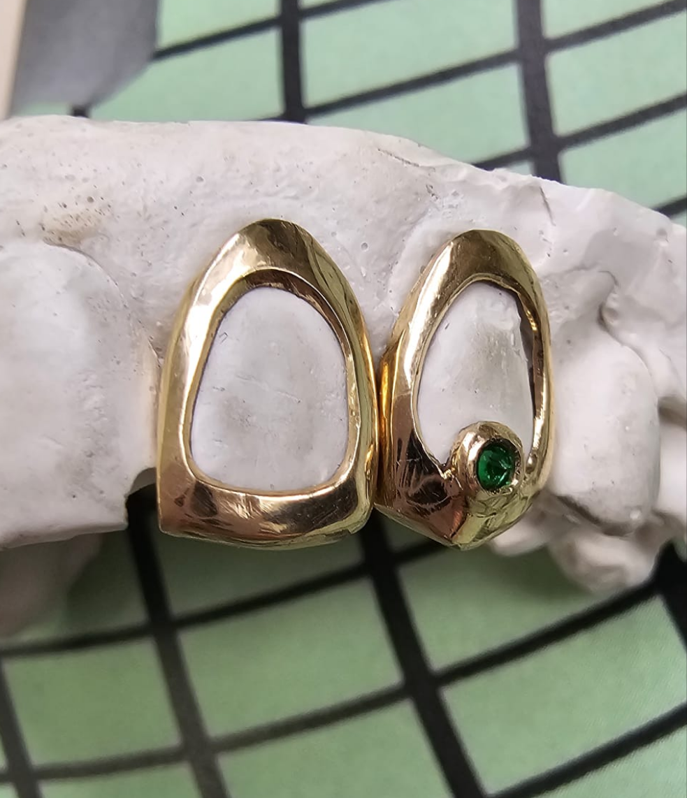 Window set with stone