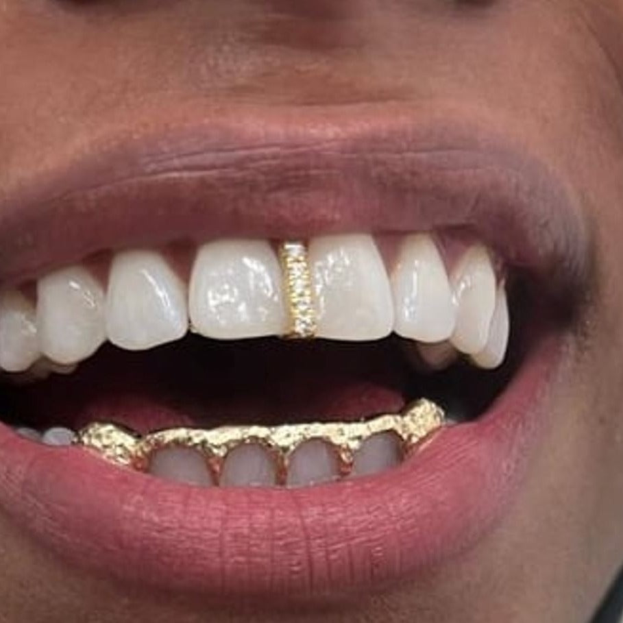 Diamond Gap filler/ Strip Design