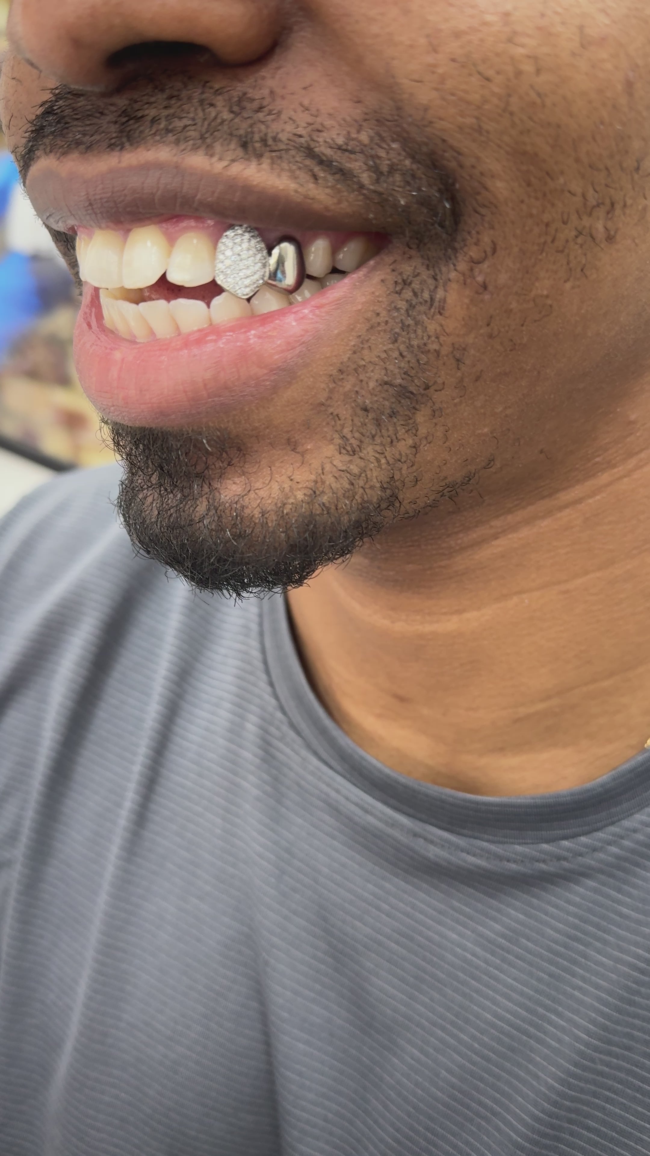 Iced out tooth