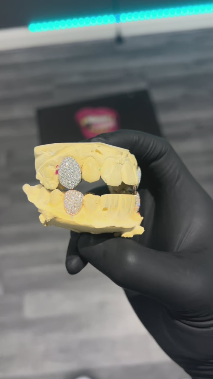 Iced out tooth